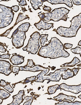 Placental alkaline phosphatase/ALPP Rabbit Polyclonal Antibody