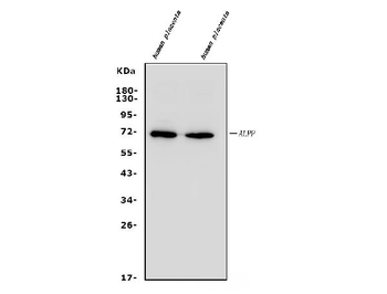 Placental alkaline phosphatase/ALPP Rabbit Polyclonal Antibody