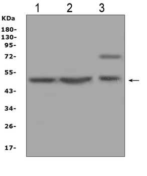 AP2M1 Rabbit Polyclonal Antibody