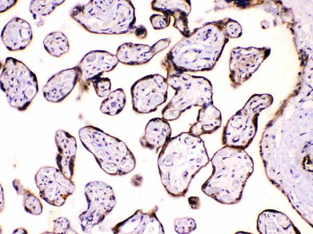 Calpastatin/CAST Rabbit Polyclonal Antibody