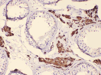 Cytochrome P450 17A1/CYP17A1 Rabbit Polyclonal Antibody
