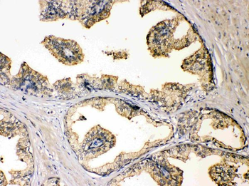 Diazepam Binding Inhibitor/DBI Rabbit Polyclonal Antibody