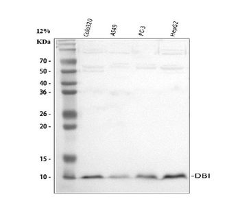 Diazepam Binding Inhibitor/DBI Rabbit Polyclonal Antibody