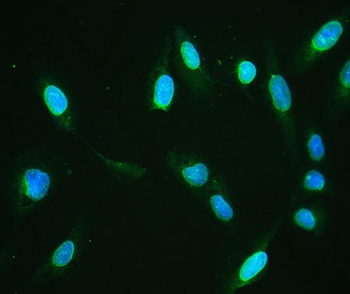 Emerin/EMD Rabbit Polyclonal Antibody