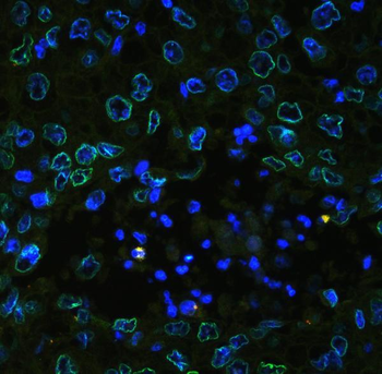 Emerin/EMD Rabbit Polyclonal Antibody