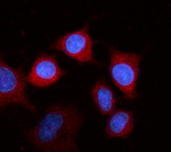Fibrinogen beta chain/FGB Rabbit Polyclonal Antibody