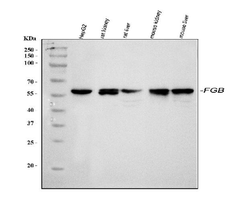 Fibrinogen beta chain/FGB Rabbit Polyclonal Antibody