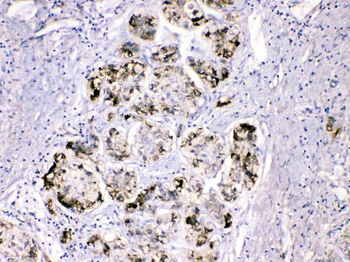 Fibrinogen gamma chain/FGG Rabbit Polyclonal Antibody