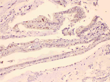 HDGF Rabbit Polyclonal Antibody