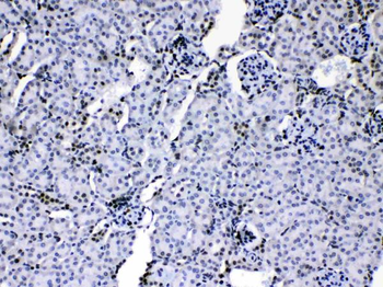 HnRNP A1/HNRNPA1 Rabbit Polyclonal Antibody