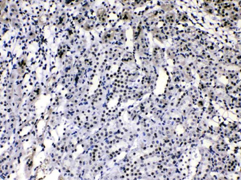 HnRNP A1/HNRNPA1 Rabbit Polyclonal Antibody