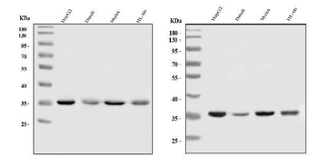 HnRNP A1/HNRNPA1 Rabbit Polyclonal Antibody