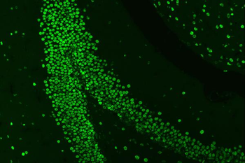 HnRNP A1/HNRNPA1 Rabbit Polyclonal Antibody