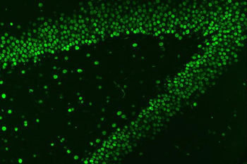 HnRNP A1/HNRNPA1 Rabbit Polyclonal Antibody