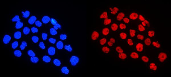 HnRNP A1/HNRNPA1 Rabbit Polyclonal Antibody
