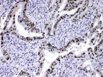 HnRNP A1/HNRNPA1 Rabbit Polyclonal Antibody
