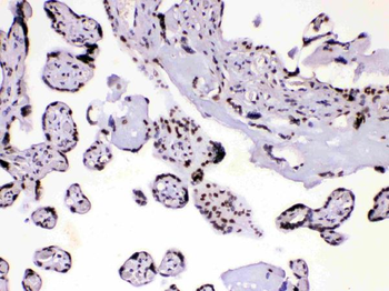 HnRNP A1/HNRNPA1 Rabbit Polyclonal Antibody
