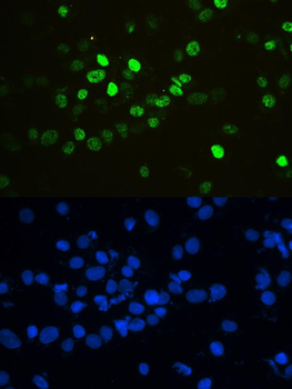 HnRNP F/HNRNPF Rabbit Polyclonal Antibody