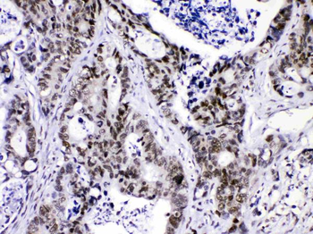 HnRNP F/HNRNPF Rabbit Polyclonal Antibody