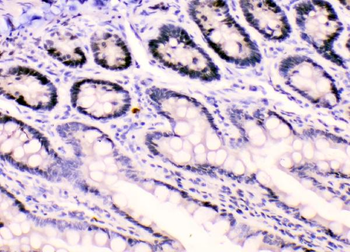 HnRNP F/HNRNPF Rabbit Polyclonal Antibody