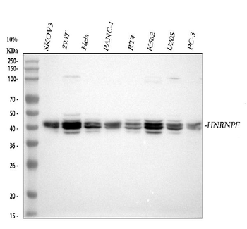 HnRNP F/HNRNPF Rabbit Polyclonal Antibody