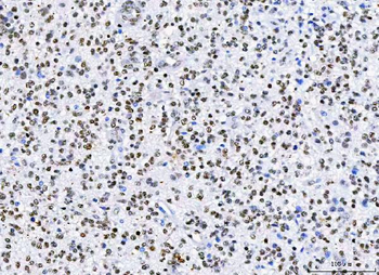 HnRNP H/HNRNPH1 Rabbit Polyclonal Antibody