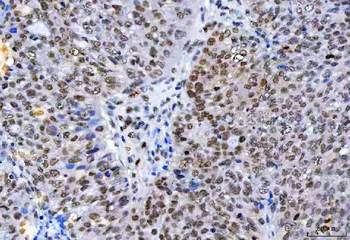 HnRNP H/HNRNPH1 Rabbit Polyclonal Antibody