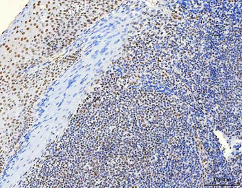 HnRNP H/HNRNPH1 Rabbit Polyclonal Antibody