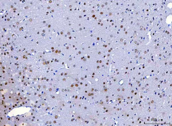 HnRNP H/HNRNPH1 Rabbit Polyclonal Antibody