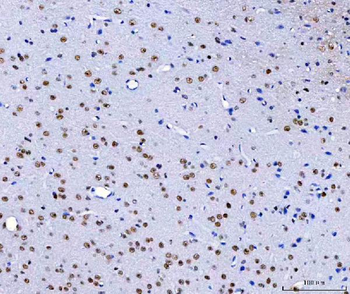 HnRNP H/HNRNPH1 Rabbit Polyclonal Antibody