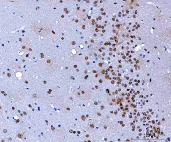 HnRNP H/HNRNPH1 Rabbit Polyclonal Antibody