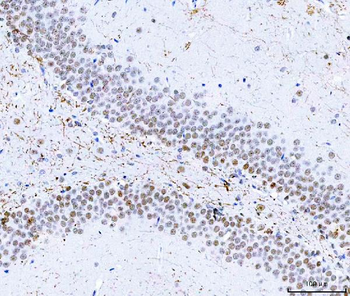 HnRNP H/HNRNPH1 Rabbit Polyclonal Antibody