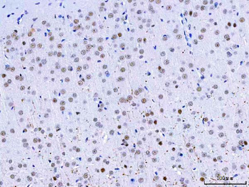 HnRNP H/HNRNPH1 Rabbit Polyclonal Antibody