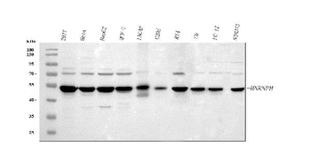 HnRNP H/HNRNPH1 Rabbit Polyclonal Antibody