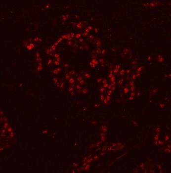 HnRNP H/HNRNPH1 Rabbit Polyclonal Antibody