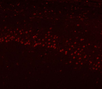HnRNP H/HNRNPH1 Rabbit Polyclonal Antibody