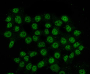 HnRNP H/HNRNPH1 Rabbit Polyclonal Antibody
