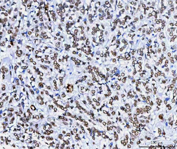 HnRNP H/HNRNPH1 Rabbit Polyclonal Antibody