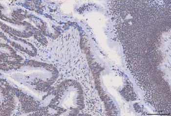 HnRNP H/HNRNPH1 Rabbit Polyclonal Antibody