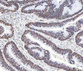 HnRNP H/HNRNPH1 Rabbit Polyclonal Antibody