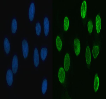 HnRNP L/HNRNPL Rabbit Polyclonal Antibody