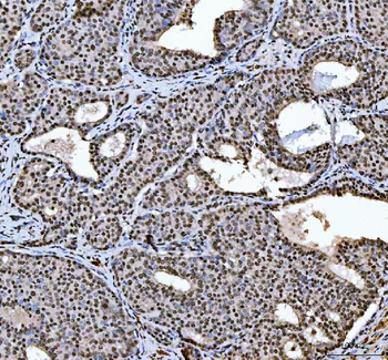 HnRNP L/HNRNPL Rabbit Polyclonal Antibody