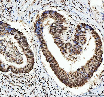 HnRNP L/HNRNPL Rabbit Polyclonal Antibody