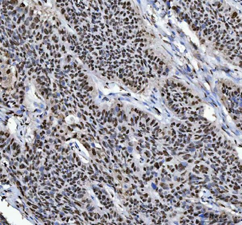 HnRNP L/HNRNPL Rabbit Polyclonal Antibody