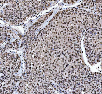 HnRNP L/HNRNPL Rabbit Polyclonal Antibody