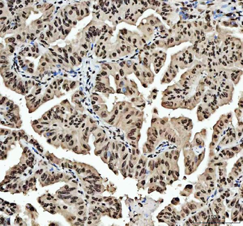 HnRNP L/HNRNPL Rabbit Polyclonal Antibody