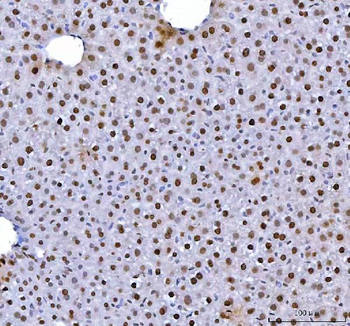 HnRNP L/HNRNPL Rabbit Polyclonal Antibody