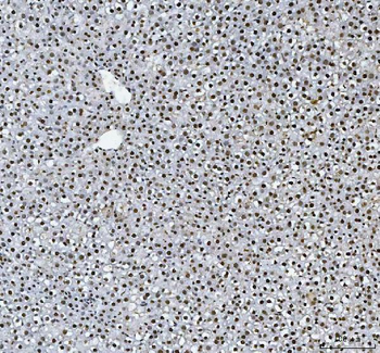 HnRNP L/HNRNPL Rabbit Polyclonal Antibody