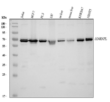 HnRNP L/HNRNPL Rabbit Polyclonal Antibody