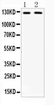CD11b/ITGAM Rabbit Polyclonal Antibody